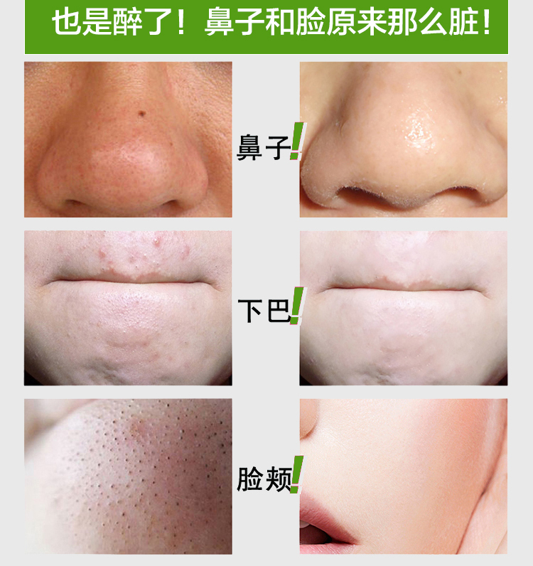面膜套装包装设计效果图宝贝描述设计
